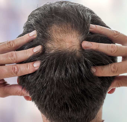 Pure Procapil hair growth peptide additive for mixing with cream or serum