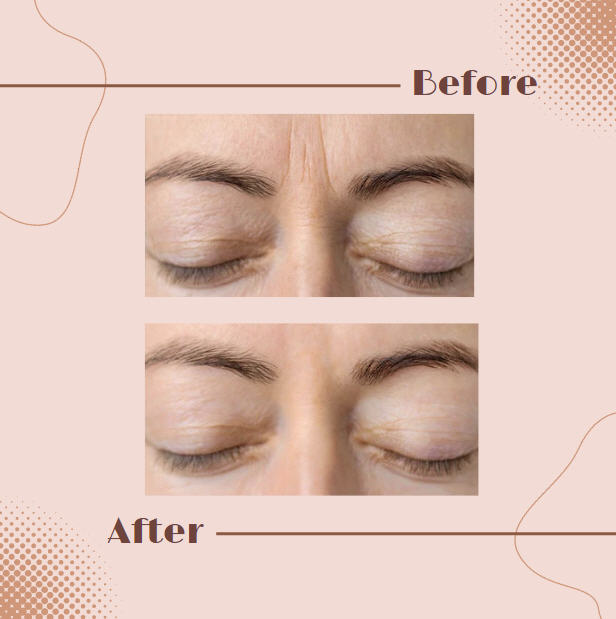 100% Hyaluronic Acid Serum with Pentapeptide-18 and Acetyl hexapeptide-3
