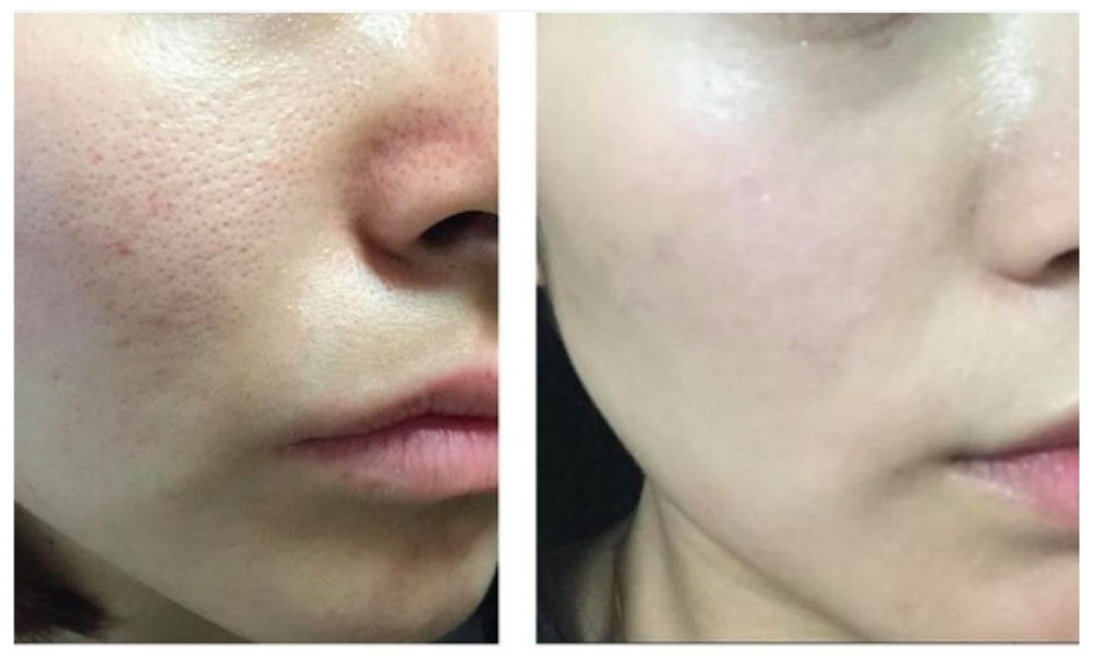 A raw peptide that is used to mix into creams and serums to make anti aging products