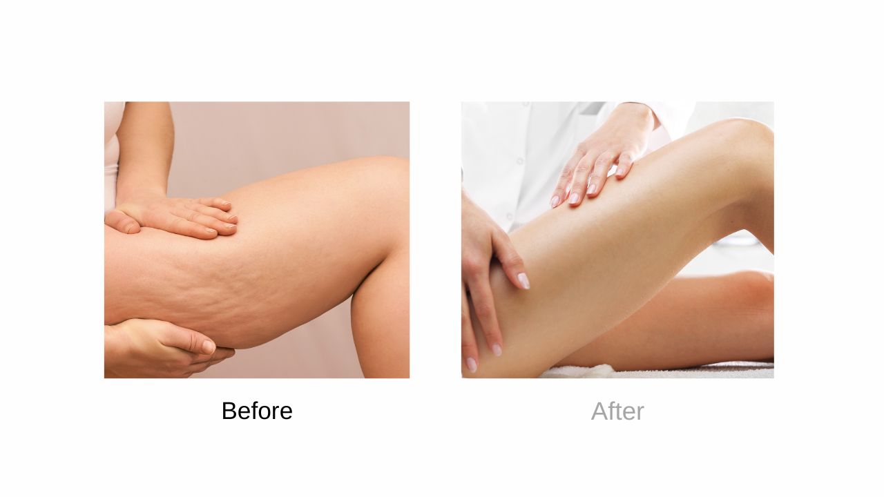 BODY FIRMING & CONTOURING