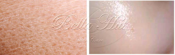 Bellahut Pomegranate Skin Renew Mask is a revitalizing treatment formulated to gently exfoliate and resurface the skin