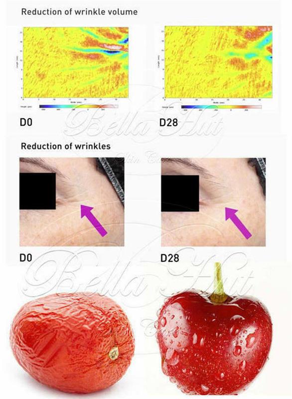 /100% Hyaluronic Acid Cream with Citrustem and Lingostem