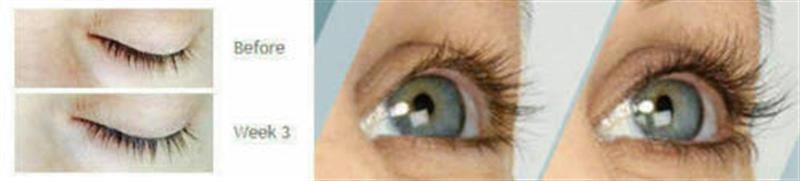 /Eyelash Growth with SymPeptide Xlash And PROCAPIL Eyelash growth and longer eyelashes