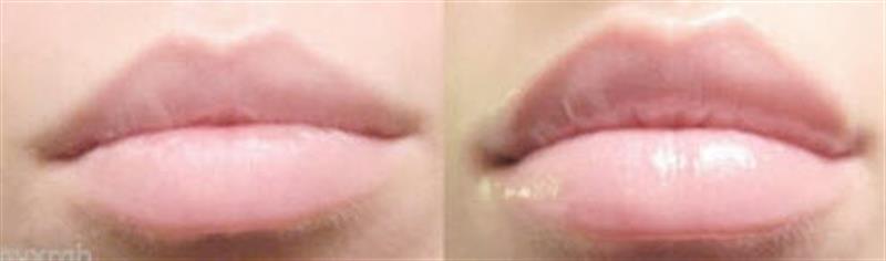 /Filling Lip Cream with Hilurlip®, Tri-Peptide-1, Hyaluronic Acid And DMAE